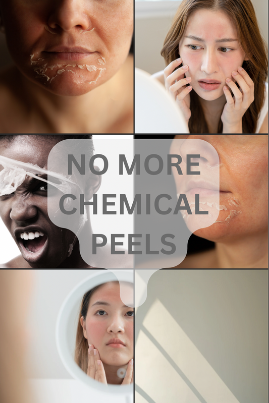 Unmasking the truth: Why Chemical Peels aren’t Worth the Hype.