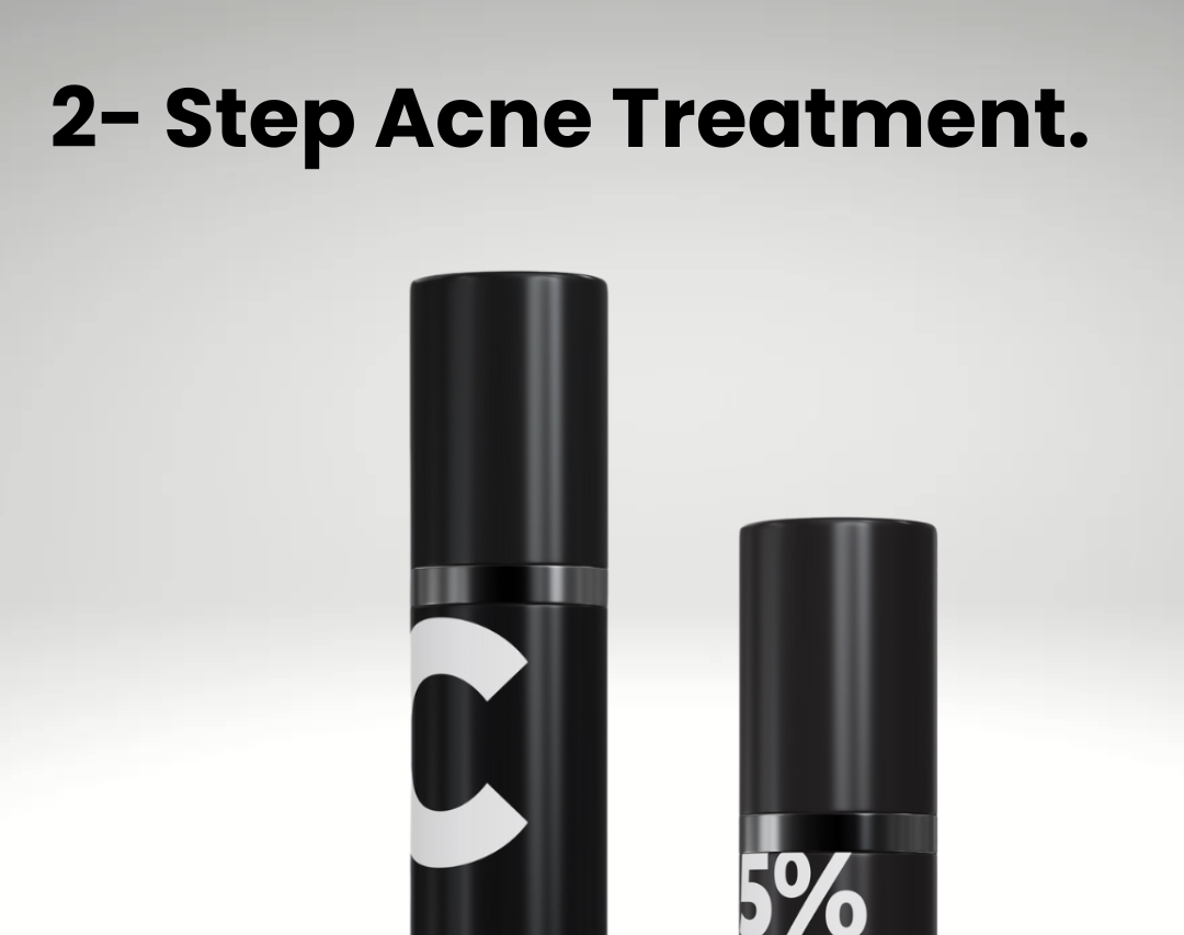 Two Acnéa skincare products on a light gray background with text '2- Step Acne Treatment'.